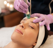 Microdermabrasion